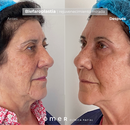 Clínica Facial Vómer