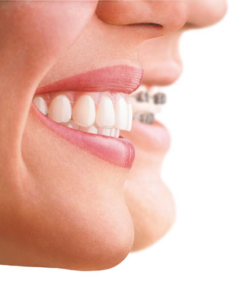 ORTODONCIA SEVILLA · Ortodoncia niños y adultos · Implantes · Estética Dental