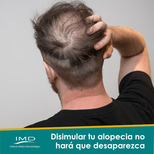 Clínica Capilar IMD - Instituto Médico Dermatológico