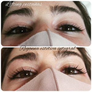 Regonna Estética Integral